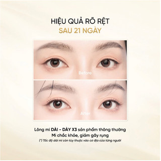 Set Long4Lashes Phong Hoa Tuyệt Đại, Serum Dưỡng Mi Long4lashes White và Son Dưỡng Túi Trong
