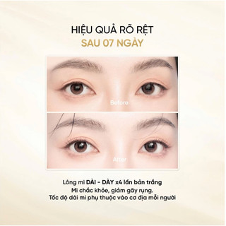 Set Long4Lashes Tiên Mi Lượng Nhãn, Serum Dưỡng Mi Long4lashes Gold và Son Dưỡng Túi Trong
