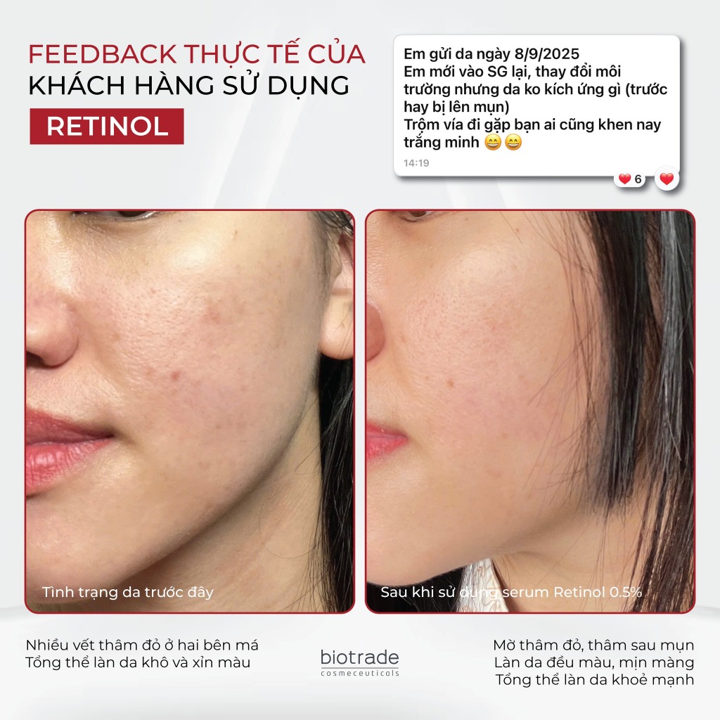Serum hỗ trợ trẻ hóa mờ thâm sáng da Biotrade Retinol 0,5% Anti-Aging 30ml - Skin Studio