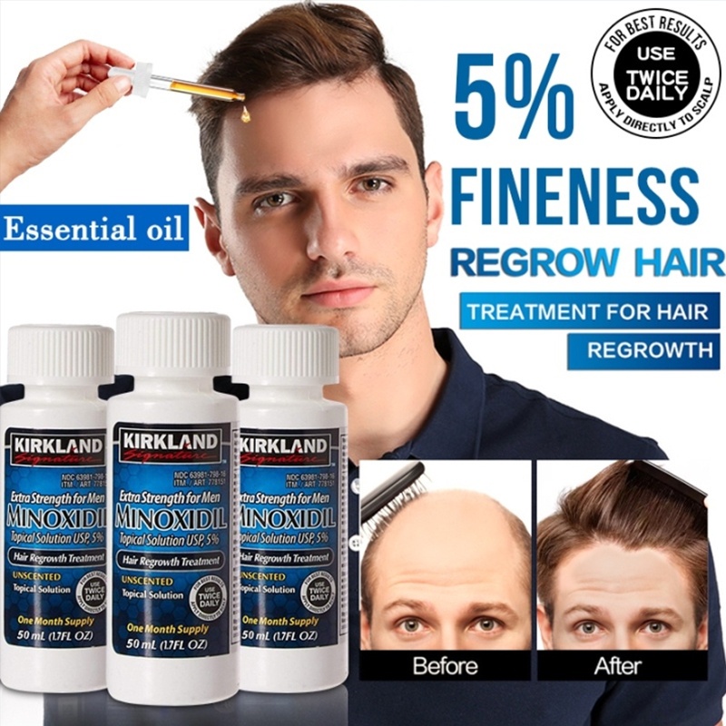 Dung dịch lỏng Seru ROGAINE 5% Minoxidil Obat penumbuh rambut penumbuh rambut cepat serum 60ml