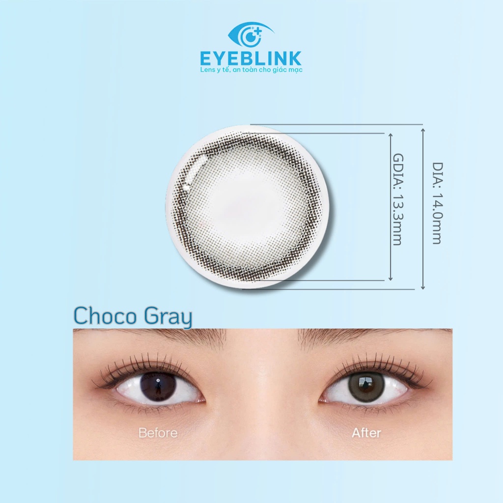 Lens y tế cấp ẩm CHOCO GRAY cho mắt nhạy cảm 12 tháng Hàn Quốc Eyeblink