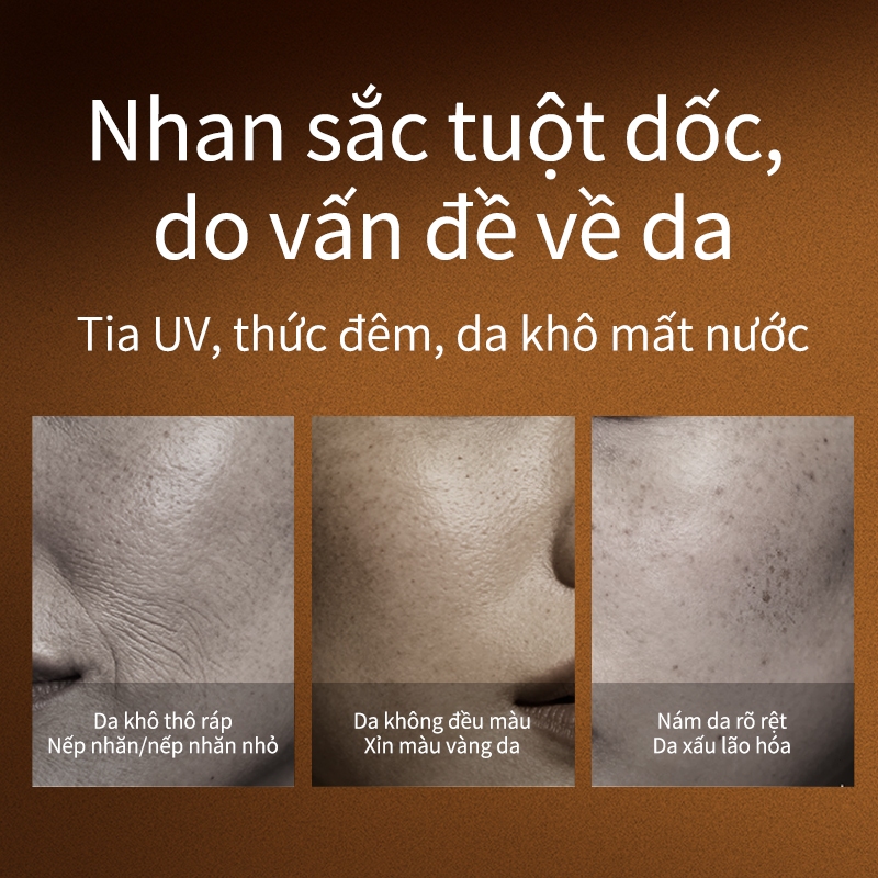 Kem làm trắng, kem dưỡng ẩm làm trắng, làm trắng chất làm mềm, cải thiện khuôn mặt khô và làn da xỉn màu 50g