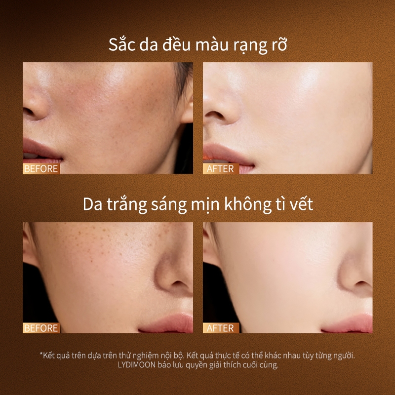 Kem làm trắng, kem dưỡng ẩm làm trắng, làm trắng chất làm mềm, cải thiện khuôn mặt khô và làn da xỉn màu 50g