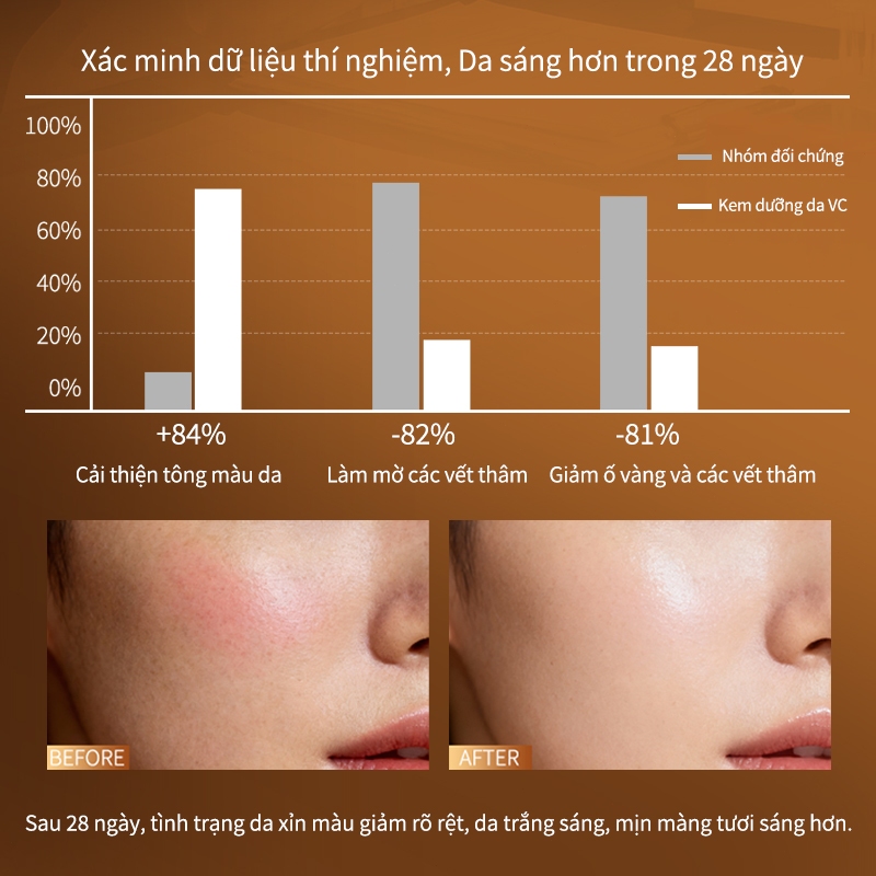 Kem làm trắng, kem dưỡng ẩm làm trắng, làm trắng chất làm mềm, cải thiện khuôn mặt khô và làn da xỉn màu 50g