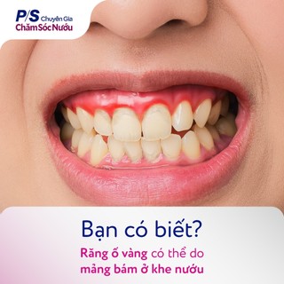[LIVE][MỚI]Bộ 2 Kem đánh răng P/S Chuyên Gia Chăm Sóc Nướu 100g-Giúp nướu khỏe, Sạch mảng bám ố vàng,Răng trắng sáng hơn