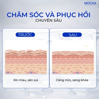 Kem Dưỡng Trắng Phục Hồi Cấp Ẩm Mocha Biovector 6 Active, Cho Cả Da Dầu Mụn Nhạy Cảm