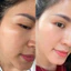 Kem N23 Duyên Thị mẫu 2025 kem trắng - Bách Y Sâm - Dưỡng Ẩm Trắng Da Mờ Nếp Nhăn 15gr 25gr (Mẫu mới nhất)