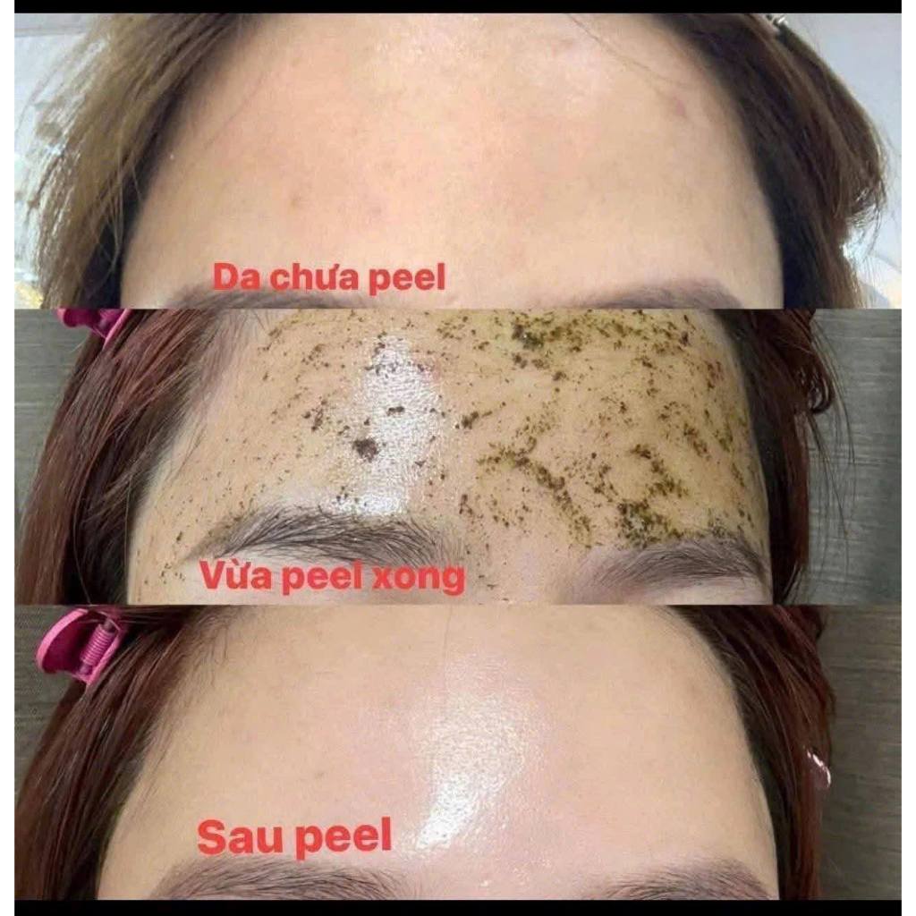 Peel tảo Christina 4A căng bóng,thu nhỏ lỗ chân lông, giảm mụn đầu đen
