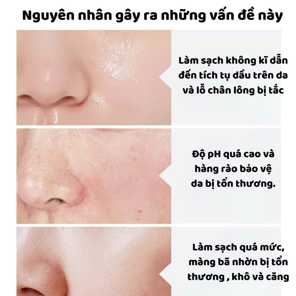 combo 3 tuýp Sữa Rửa Mặt Aufuxue Tuýp 100g Giảm Mụn Dầu Nhờn Dưỡng Trắng Da, Sữa Rửa Mặt Trắng Da