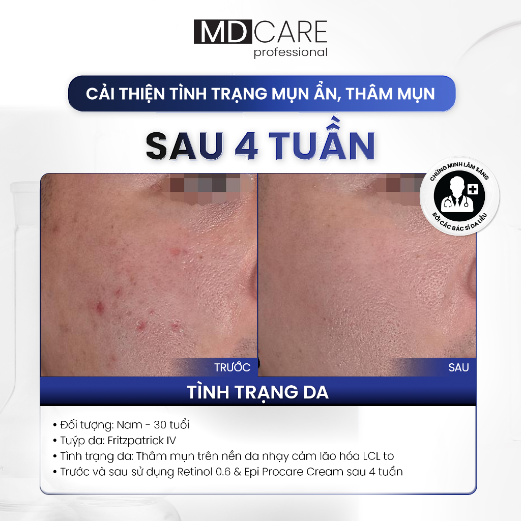 [HÀNG CÔNG TY] Kem Dưỡng MD CARE PRO-RETINOL 0.6% - 1% Làm Sáng Và Cải Thiện Nếp Nhăn Duduhouse | BigBuy360 - bigbuy360.vn