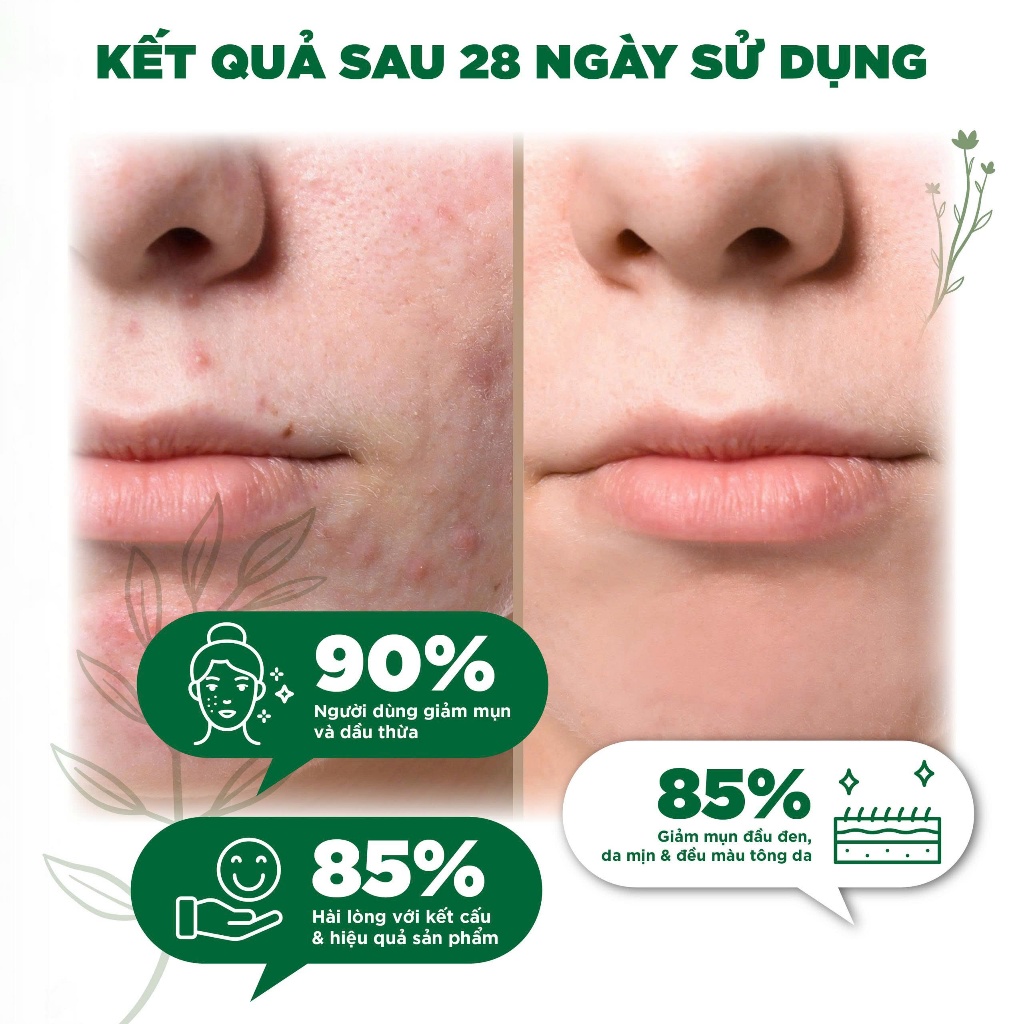 [Hàng Công Ty NK&PP ] Kem dưỡng da NUBIANCE. PARIS ACT-5 Multi-Perfecting Pore Corrector 30ml