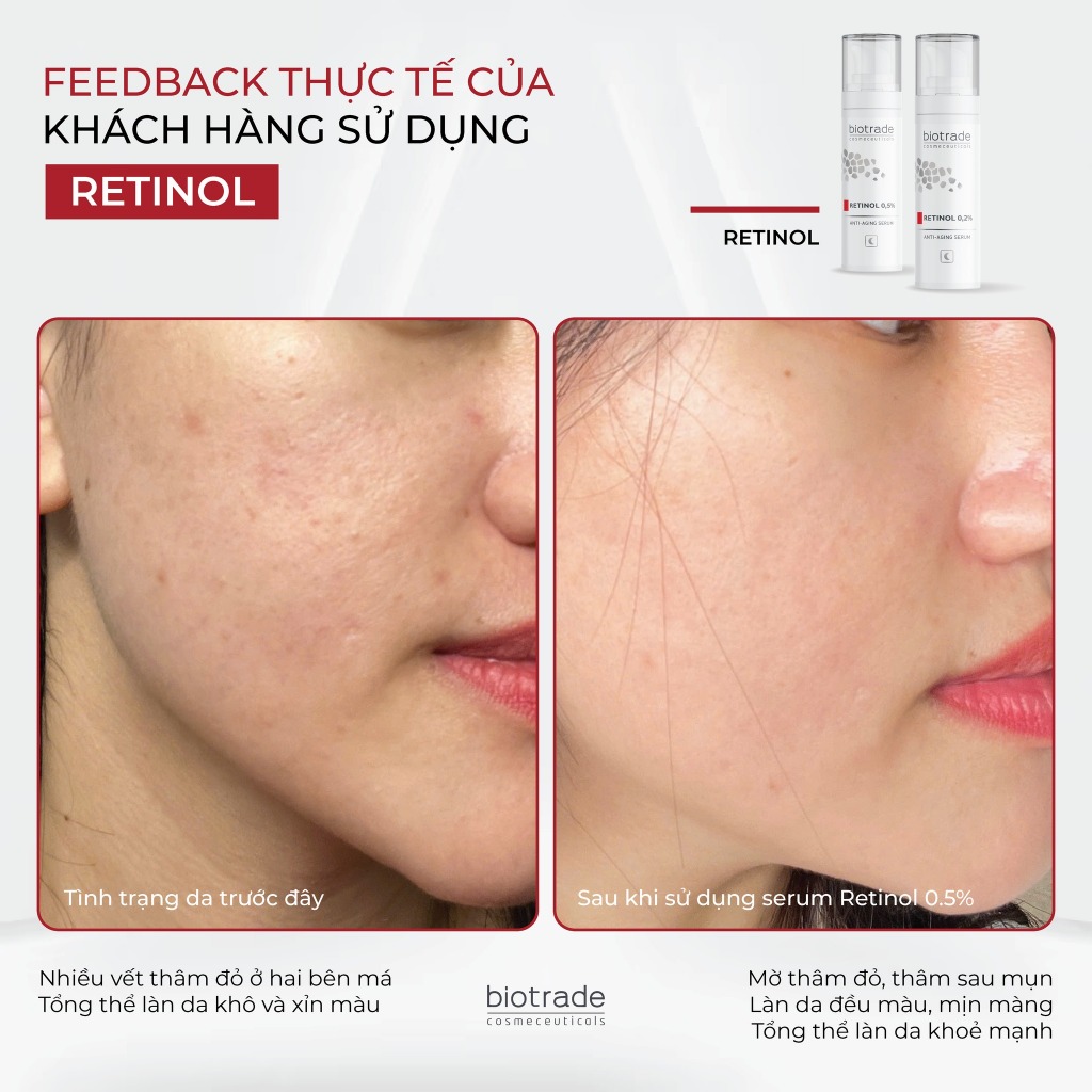 Serum hỗ trợ trẻ hóa mờ thâm sáng da Biotrade Retinol 0,5% Anti-Aging 30ml - Skin Studio