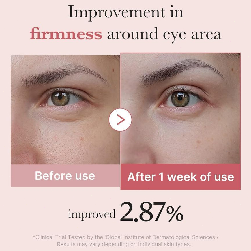Tinh Chất Làm Sáng, Giảm Nhăn, Săn Chắc Vùng Da Mắt MEDICUBE PDRN Pink Peptide Eye Cream 30ml