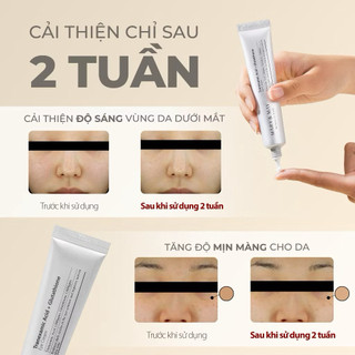 [Mary&May] Kem Mắt Dưỡng Hỗ Trợ Giảm Thâm Quầng Mắt MARY AND MAY Tranexamic Acid + Glutathion Eye Cream 12g