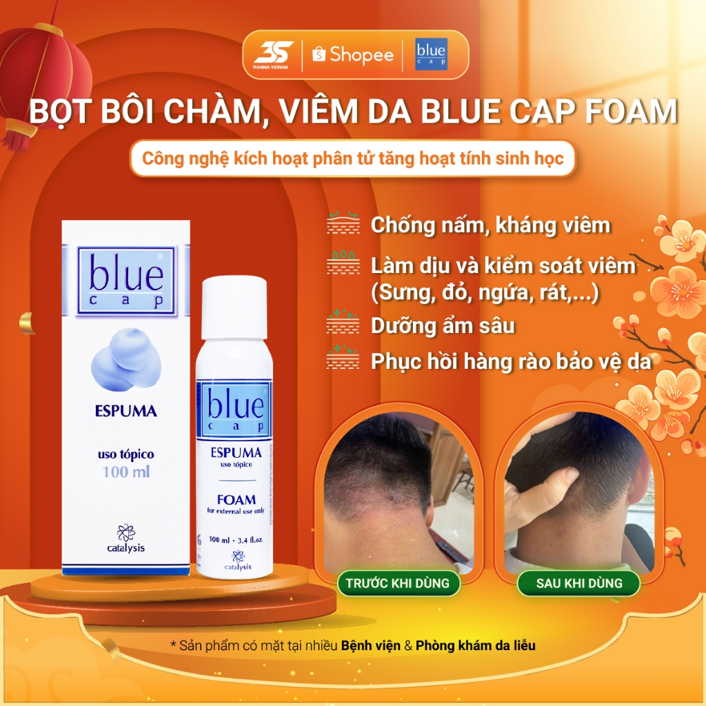 Blue Cap Foam Hỗ Trợ Giảm Vảy Nến, Viêm Da Cơ Địa, Khô Rát, Ngứa, Bong Tróc, Dạng bọt, 100ml