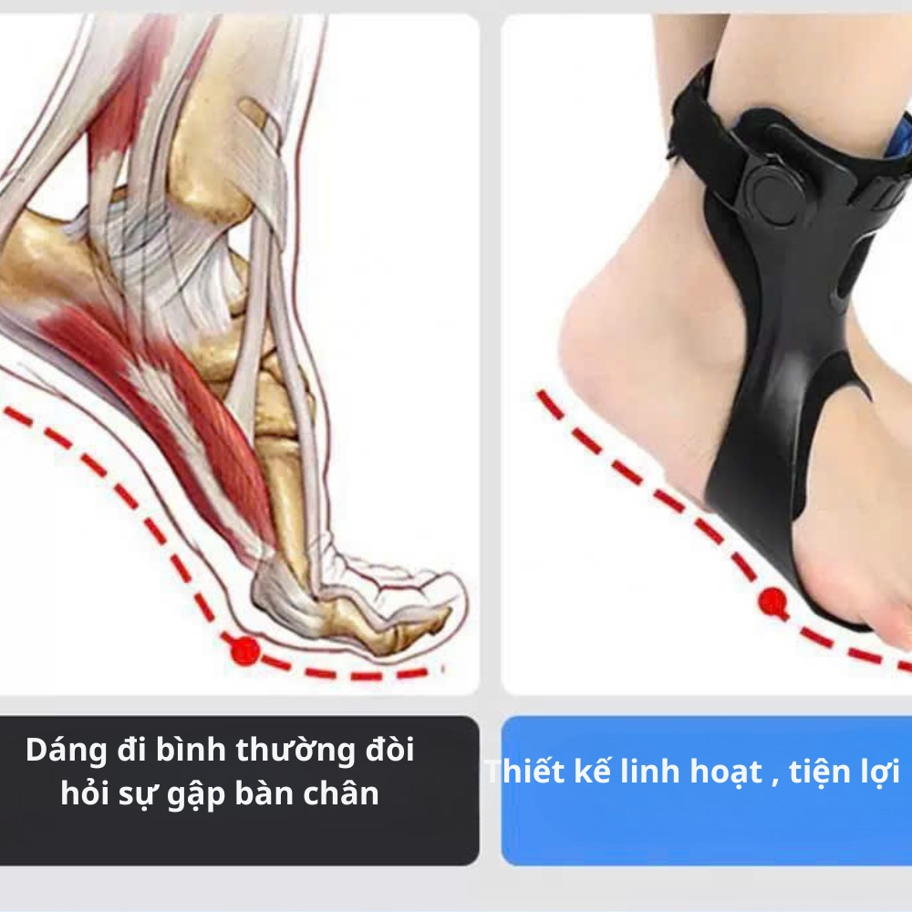 Nẹp Chỉnh Hình Bàn Chân Rũ Sau Tai Biến – Hỗ trợ đi lại, chống bàn chân rũ