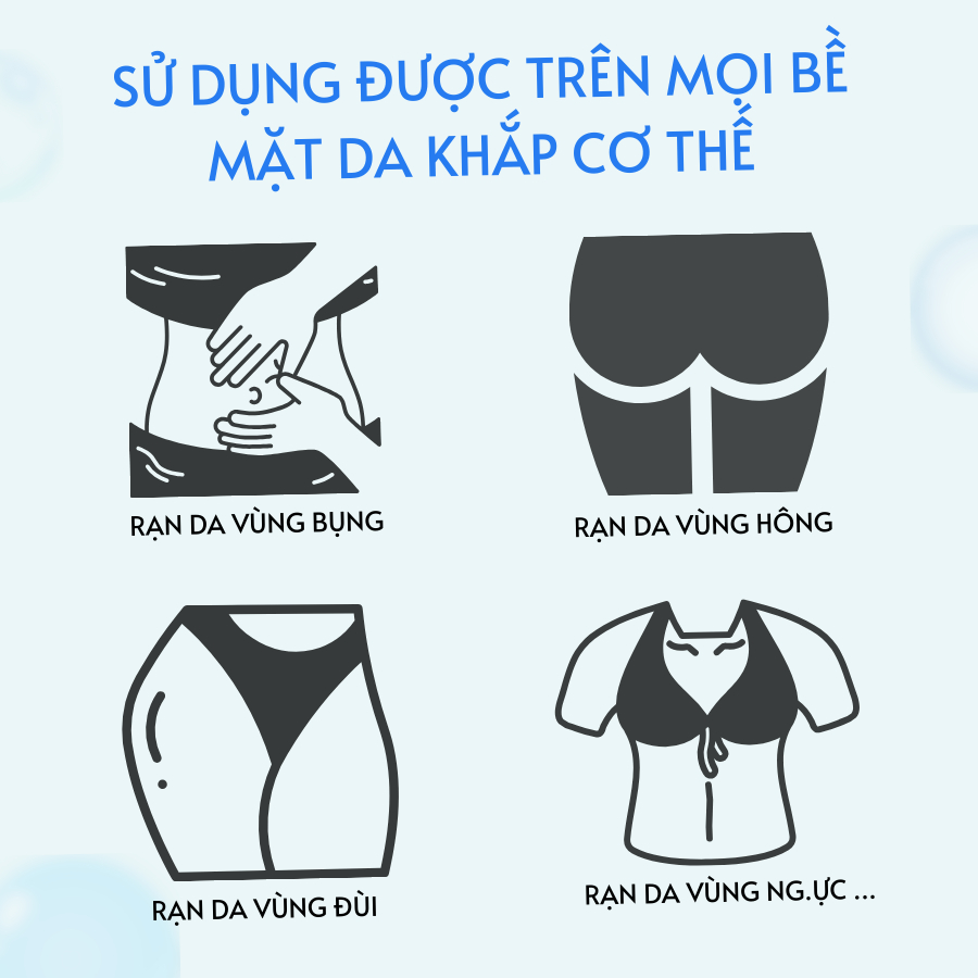 Combo 2 Tuýp Kem Mờ Rạn Da Anti Stretch Dưỡng Ẩm, Hỗ Trợ Cải Thiện Thâm, Rạn Da Cho Mẹ Bầu Sau Sinh Và Tuổi Dậy Thì