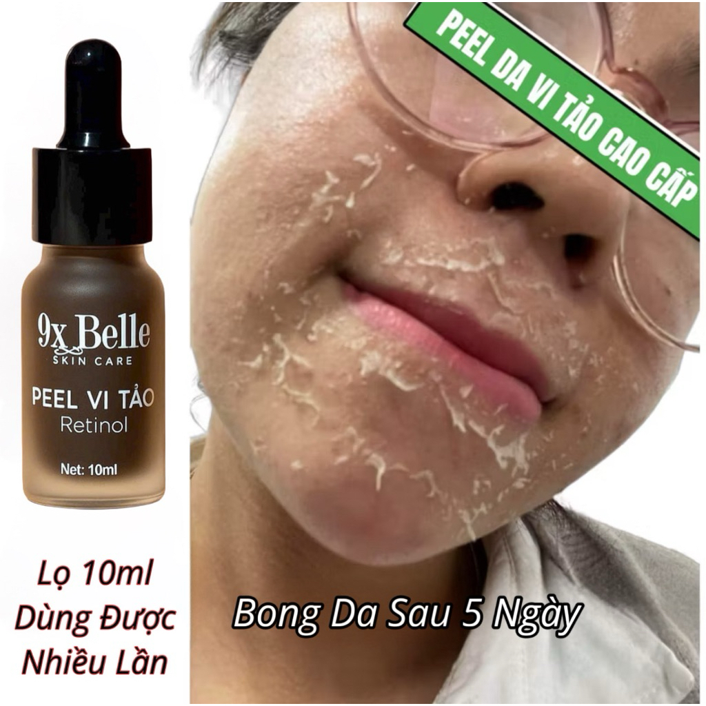 PEEL DA MẶT VI TẢO CAO CẤP - tẩy da chết - giảm mụn mờ nám tàn nhang - peel lột da mặt retinol 10ml