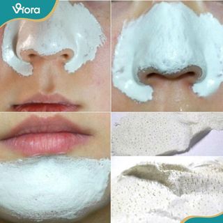 (COMBO SIÊU RẺ) Gel Lột Mụn 150g + Mặt Nạ Giấy 100c SOLÉA -Dễ Dàng Lột Sạch Mụn Đầu Đen - VIORA SHOP