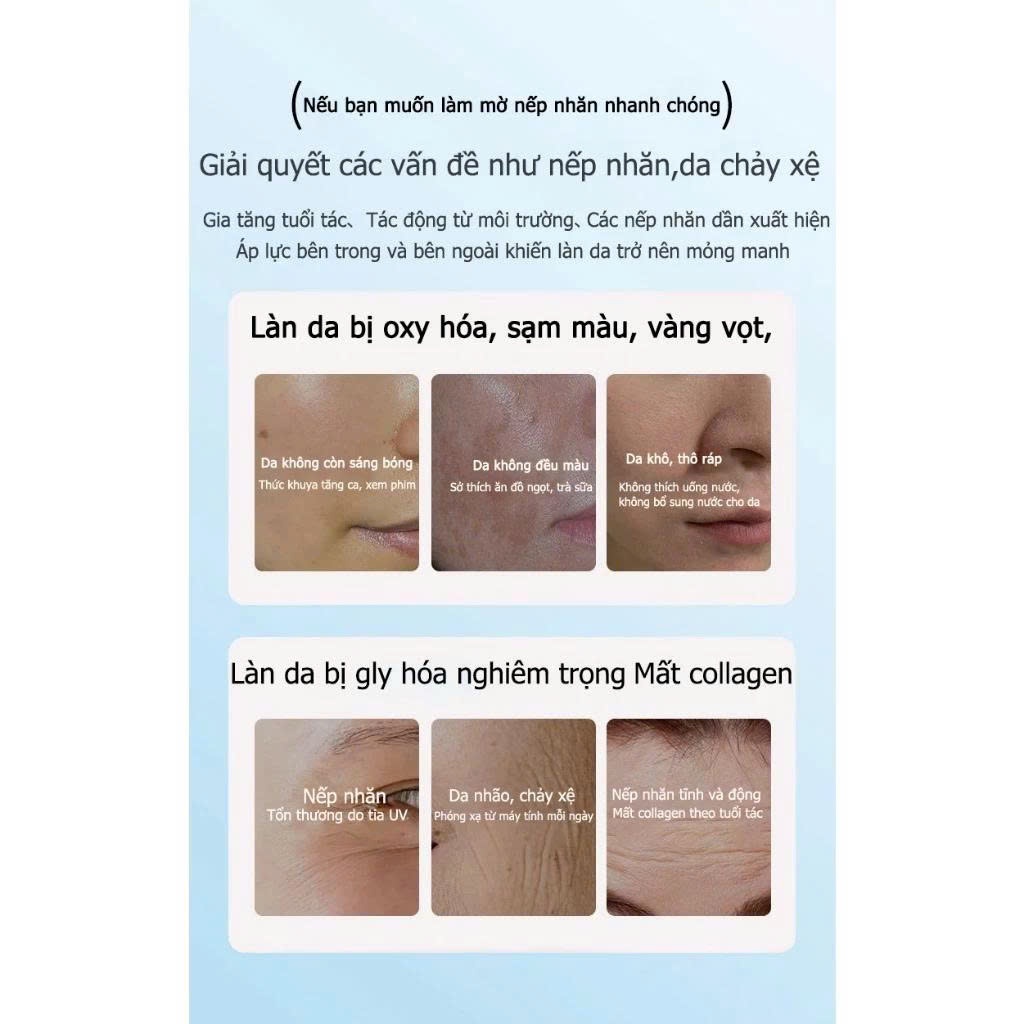 Combo Kem Dưỡng Trắng Trẻ Hóa Da MMEIR 377 Whitening Lady Cream – Kem MméiR Làm Sáng Da, Căng Bóng Tự Nhiên, Giảm Nhăn