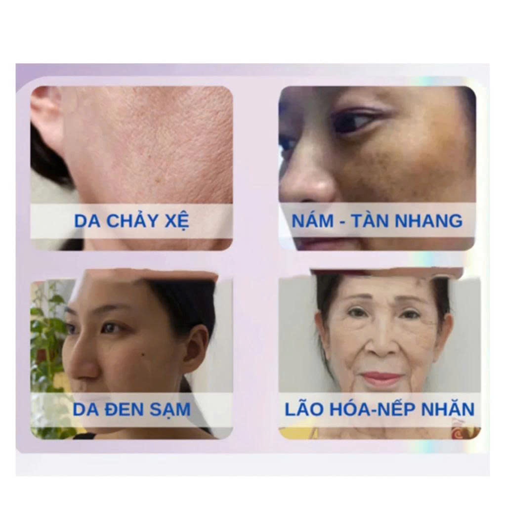 Kem Dưỡng Trắng Trẻ Hóa Da MMEIR 377 Whitening Lady Cream – Kem MméiR Làm Sáng Da, Căng Bóng Tự Nhiên, Giảm Nhăn