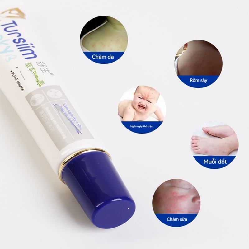 Kem Chống Ngứa Cho Bé 16g Giảm Rôm Sảy Muỗi Đốt Hăm Tã Chàm Sữa Dưỡng Ẩm Làm Dịu Da Trẻ Em