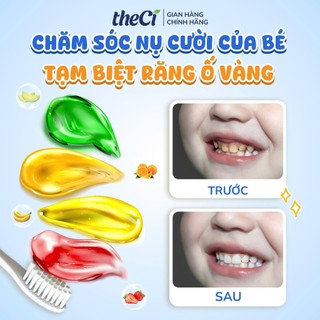 Combo 2 Kem Đánh Răng Tặng 1 - Kem Đánh Răng theCi Cho Bé Tập Đánh Răng Thành Phần Tự Nhiên Có Thể Buốt Được Không Flo