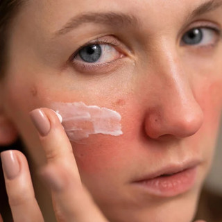[HÀNG CÔNG TY] Kem dưỡng ẩm BANDI VENO CARE Redness-reducing cream-gel dành cho da nhạy cảm