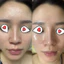 SỮA DƯỠNG PHỤC HỒI VÀ LÀM DỊU DA TEOXANE POST PROCEDURE SOOTHING AFTERCARE FLUID