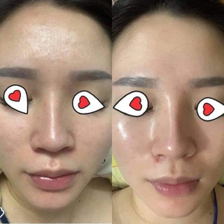 [CÔNG TY] SỮA DƯỠNG PHỤC HỒI VÀ LÀM DỊU DA TEOXANE POST PROCEDURE SOOTHING AFTERCARE FLUID
