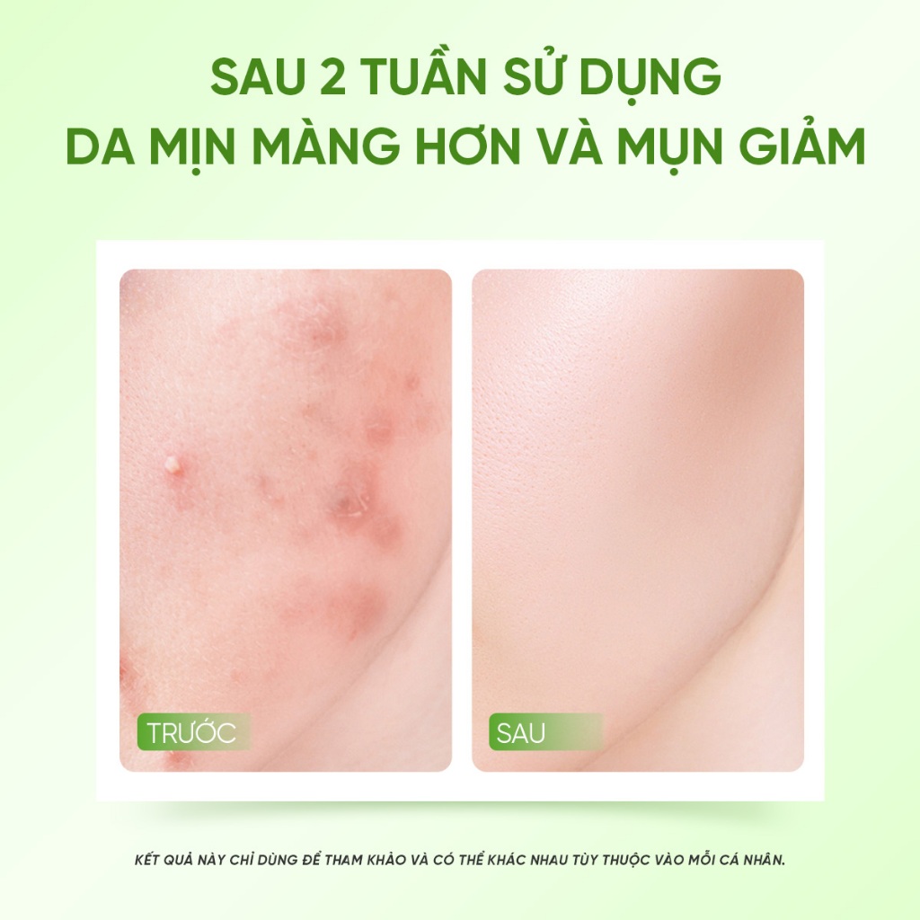 Serum Giảm Mụn The Originote chấm mụn làm dịu da se khít lỗ chân lông kiểm soát dầu tinh chất với Salicylic Acid 20ml