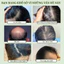 Side Cypress Leaf Xà phòng gội đầu thảo dược từ cỏ Usma Tân Cương giảm dầu và ngăn ngừa rụng tóc Dưỡng Tóc
