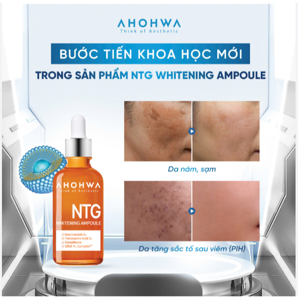 [ĐẠI LÝ CHÍNH HÃNG]Tinh chất dưỡng trắng, mờ thâm nám Ahohwa Whitening Ampoule NTG