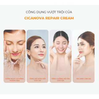 [HÀNG CÔNG TY] Kem ngừa sẹo, phục hồi da tổn thương Canova Cicanova Repair Cream (50ml)