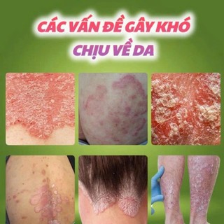 Kem Bôi Da Heyoul Hàn Quốc Hỗ Trợ Giảm Mẩn Ngứa Viêm Da Cơ Địa, Chăm Sóc Da Hằng Ngày 20g
