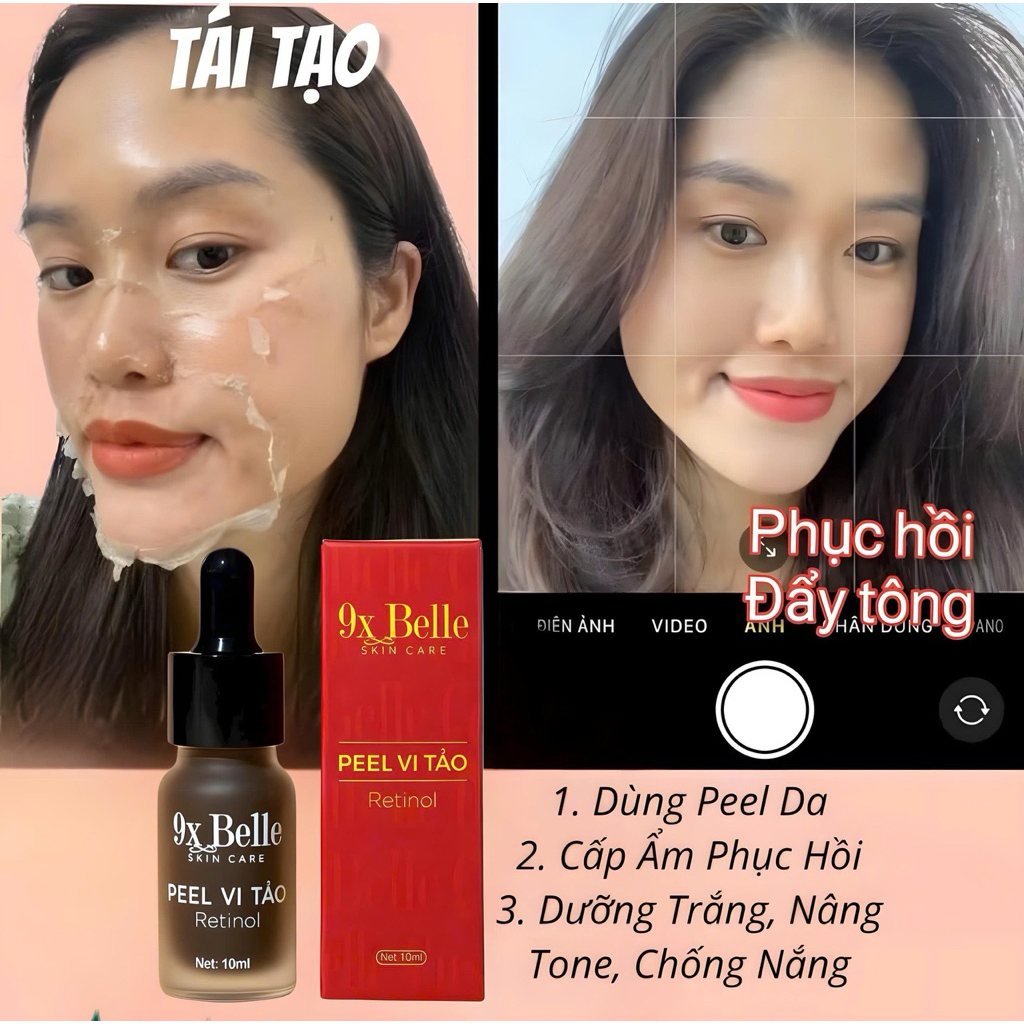 PEEL DA MẶT VI TẢO CAO CẤP - tẩy da chết - giảm mụn mờ nám tàn nhang - peel lột da mặt retinol 10ml