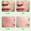 Gel Tẩy Tế Bào Chết TẨY DA CHẾT làm sạch lớp da sần sùi, giúp da thông thoáng mịn màng