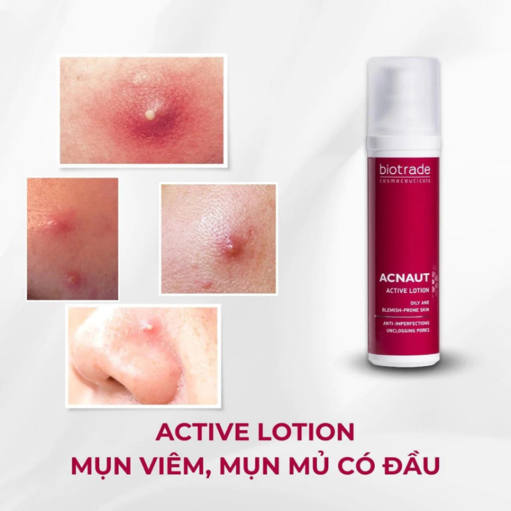 [MALL] Dung dịch chấm mụn BIOTRADE ACNAUT ACTIVE LOTION 15ml giảm mụn sưng, mụn mủ - Skin Studio