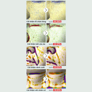 Tinh chất vi kim PESTLO Rejurecipe MTS Roller Serum 50ml