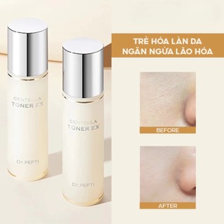 Nước hoa hồng Dr.Pepti toner Dr.Pepti dưỡng da căng bóng Centella Toner EX 180ml - Kosmi Beauty
