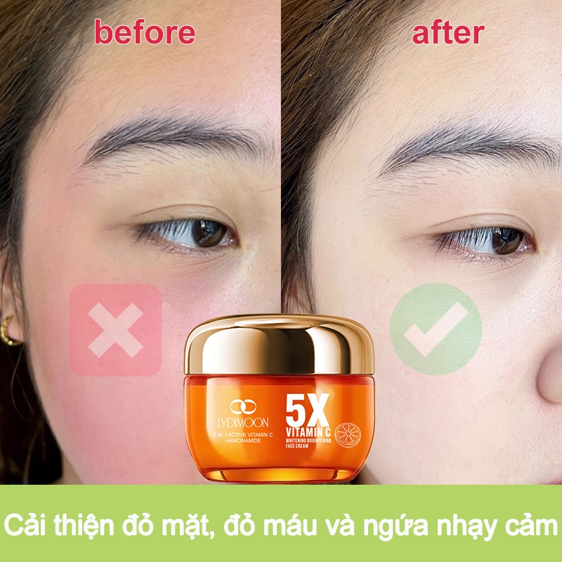 Kem làm trắng, kem dưỡng ẩm làm trắng, làm trắng chất làm mềm, cải thiện khuôn mặt khô và làn da xỉn màu 50g