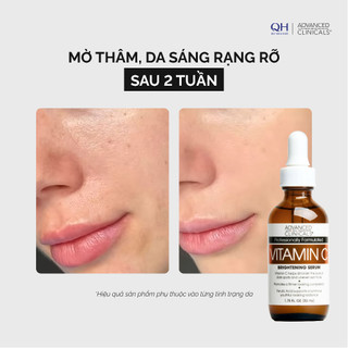 Serum Vitamin C AAP Dưỡng Sáng Mờ Thâm Sạm Giúp Làm Đều Màu Da Chống Oxy Hoá Advanced Clinicals 52ml