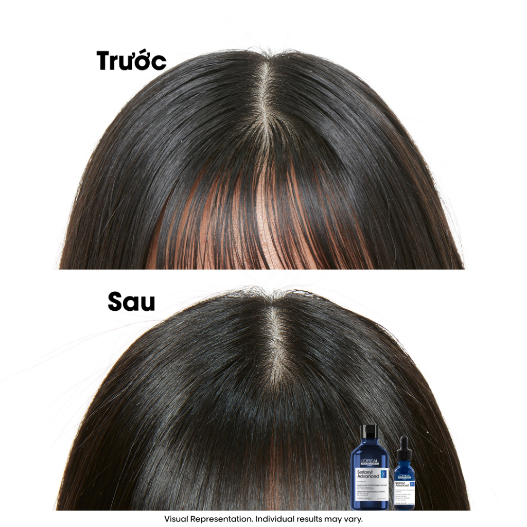 Tinh chất tăng mật độ làm dày tóc chuyên nghiệp L'Oréal Professionnel Serioxyl Advanced 30ml - Dành cho tóc thưa, mảnh