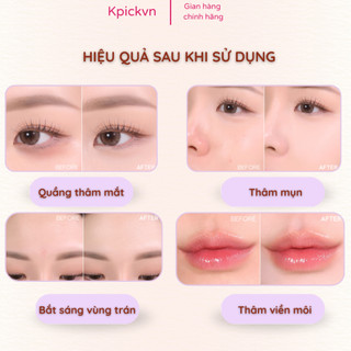 Che Khuyết Điểm Triệt Sắc Twoedit Dual Color Corrector (3g) - Che Mụn Đỏ, Quầng Thâm, Làm Đều Màu Da