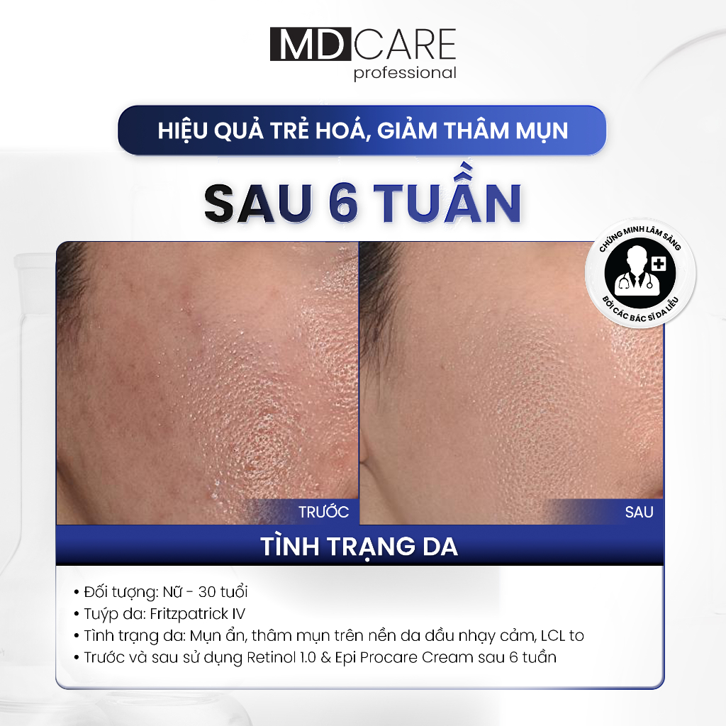 [HÀNG CÔNG TY] Kem Dưỡng MD CARE PRO-RETINOL 0.6% - 1% Làm Sáng Và Cải Thiện Nếp Nhăn Duduhouse | BigBuy360 - bigbuy360.vn