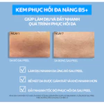 Kem Dưỡng Ẩm & Phục Hồi Đa Năng La Roche-Posay Cicaplast Baume B5+ (100ml) giúp phục hồi da sau 1 lần sử dụng — ảnh 8