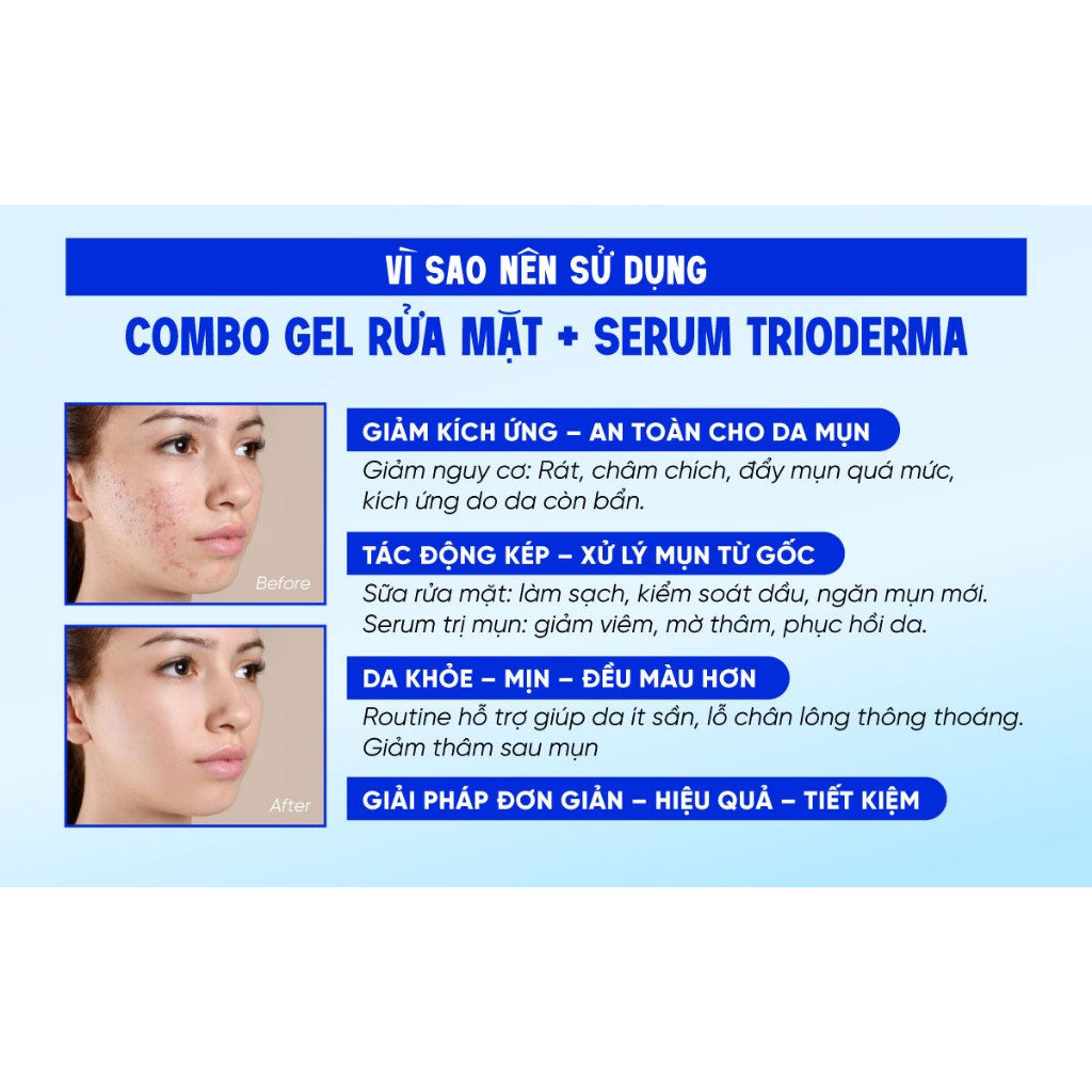 Bộ đôi làm sạch sâu giảm mụn nhanh gel rửa mặt & serum sáng da mờ thâm 30ml Trioderma