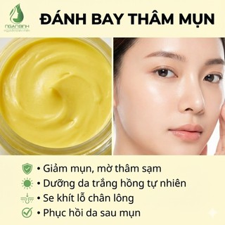 [TẶNG CỌ/QUE] Cao tinh nghệ Ngân Bình đắp mặt - Chất kem từ 2013 giảm mụn, mờ thâm