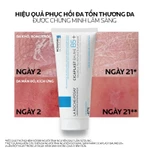 Kem Dưỡng Ẩm & Phục Hồi Đa Năng La Roche-Posay Cicaplast Baume B5+ (100ml) giúp phục hồi da sau 1 lần sử dụng — ảnh 5