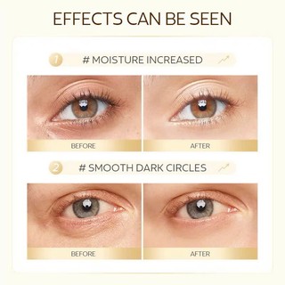 Mặt Nạ Mắt Collagen BIOAQUA 60 Miếng Chống Oxy Hóa Làm Sáng Vòng Tròn Tối, Mặt Nạ Mắt Chống Lão Hóa 30 Cặp, Vân Thỏ